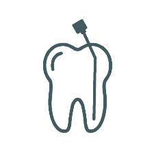 Endodoncia / Tratamiento de Conducto